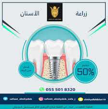 صفوة المهيدب لطب الأسنان جده Home Facebook