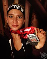 Her Leg So Broken It Had To Be Amputated, See How This Sports Fan Adjusted  To Disabled Life