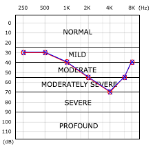 Understanding your audiogram is the first step to knowing if you have hearing loss, how hearing loss may impact you, and what kind of treatment you might benefit from. Audiogram How To Read A Hearing Test Pro Fit Hearing