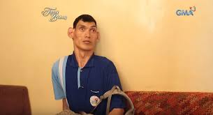 Derita Gigantisme, Pria Ini Tingginya Mencapai 2,2 Meter, Begini Ia  Diperlakukan Masyarakat