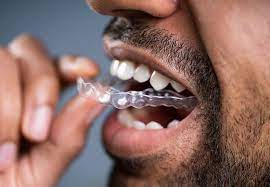 Mouthguards pick up bacteria from your mouth. Should You Use A Dental Mouthguard For Your Jaw Pain Health Essentials From Cleveland Clinic