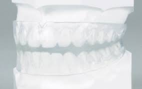 治療後のケア（保定） | 尾崎矯正歯科クリニック