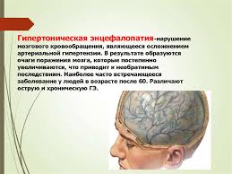 Причина развития патологии связана с определенными. Gipertonicheskaya Encefalopatiya Prezentaciya Onlajn
