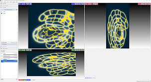 3D UNet Arabidopsis Ovules | Zenodo