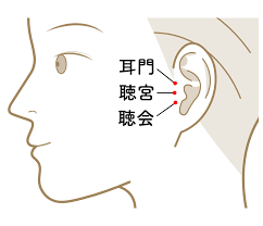 イヤホン難聴 | リカバリー鍼灸院