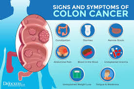 A lymph node affected by lymphoma will feel like a hard, rubbery lump under your dog's skin. Colon Cancer Symptoms Causes And Support Strategies