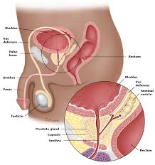 However, you cannot make a diagnosis of prostate cancer based on a blood test. 6 Things You Need To Know About Prostate Cancer Lifestyle Rojak Daily