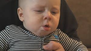 Whooping cough cases