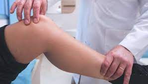 The knee is bent upwards beyond the straight position it's supposed to have. Hyperextended Knee Symptoms Treatment Recovery