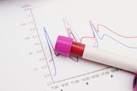 Was ihr daraus macht, liegt an euch oder ergibt sich aus der nachricht selbst. Blutwerte Der Prostata Psa Wert Zu Hoch Prostata Krebs Erkennung