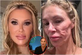 Surgeon's Urgent Alert to Brandi Glanville: Unveiling a Fresh Theory
