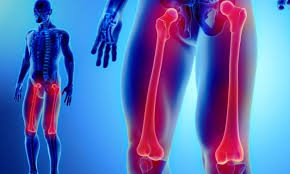 Sănătate publică, economie şi management în medicină. AfecÅ£iuni Sold CoapsÄ Ortopedia Pe InÅ£elesul Tuturor