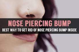 Best Way To Get Rid Of Nose Piercing Bump Inside Piercing Bump Nose Piercing Bump Nose Piercing Placement
