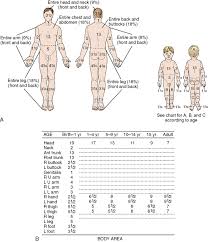 Care Of The Child With Burns Clinical Gate