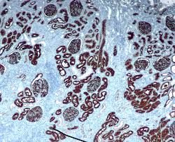 No terms for ihc in company. Immunohistochemistry Wikipedia