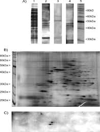 The lysosomes are oval and the vacuoles are more rounded.) 1. The Mycobacterium Tuberculosis Cell Surface Glycoprotein Apa As A Potential Adhesin To Colonize Target Cells Via The Innate Immune System Pulmonary C Type Lectin Surfactant Protein A Journal Of Biological Chemistry
