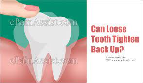 These can heal and tighten if the tooth is kept in place, often within a few weeks. Can Loose Tooth Tighten Back Up