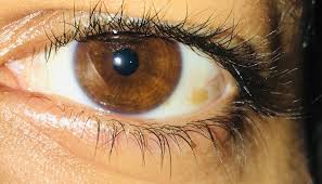 Gelbe Flecke Im Auge Was Kann Der Grund Sein Foto Gesundheit Und Medizin Gesundheit Liebe Und Beziehung