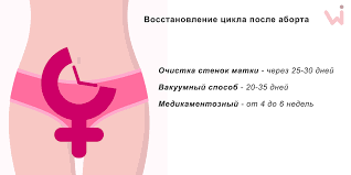 Mesyachnye Posle Aborta Mesyachnye Posle Medikamentoznogo I Vakuumnogo Aborta Kogda Nachinayutsya