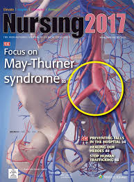 Acute Iliofemoral Dvt In The Presence Of May Thurner Syndrome Article Nursingcenter