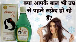 / 500 ml) 5.0 out of 5 stars 4. Arnica Hair Oil Arnica Oil Arnica Oil Review Fashion Pritty Girl Youtube