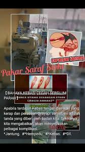 Pakar Rawatan Saraf Stroke Posts Facebook