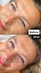 Looking for content models for the below treatments