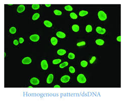 Image result for ANA Staining Pattern