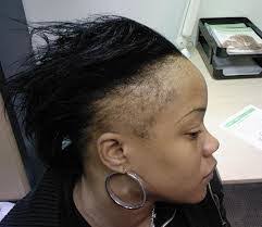 Relaxed hair is more likely to break when it's braided, so she asks patients who are wearing extensions and also use relaxers to space out chemical treatments, for at. Hair Growth Baldness Treatment For Black Men Stop Your Hair Loss Now Health Nigeria