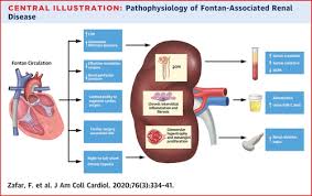 This is the currently selected item. Long Term Kidney Function After The Fontan Operation Jacc Review Topic Of The Week Journal Of The American College Of Cardiology