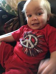 Prayer request for upcoming surgeries