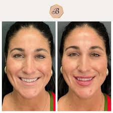 A little filler, a lot of confidence. Subtle, balanced, and beautifully  enhanced — our lip filler treatments are tailored to you for  natural-looking results you'll love. Swipe to see the glow-up! 💉