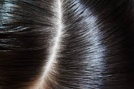 Saw palmetto oil, pumpkin seed oil, and cranberry seed oil. Saw Palmetto For Hair Loss Does It Work Sunday Edit