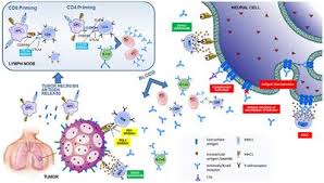 Learn about this uncommon cancer that's linked to asbestos exposure. Frontiers Paraneoplastic Neurological Syndromes And Beyond Emerging With The Introduction Of Immune Checkpoint Inhibitor Cancer Immunotherapy Neurology