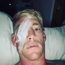 Welsh bareknuckle boxing legend almost blinded as he's forced to walk away  from fighting