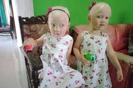 Novel ini mengangkat tema yaitu petualan. Anak Kembar Albino Di Wonogiri Viral Banyak Yang Datang Ke Rumah Untuk Foto Solopos Com
