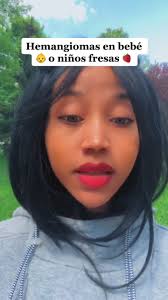 Hemangiomas en Bebes 👶niñas fresas 🍓#hemangiomababy #hemangiomas #he...