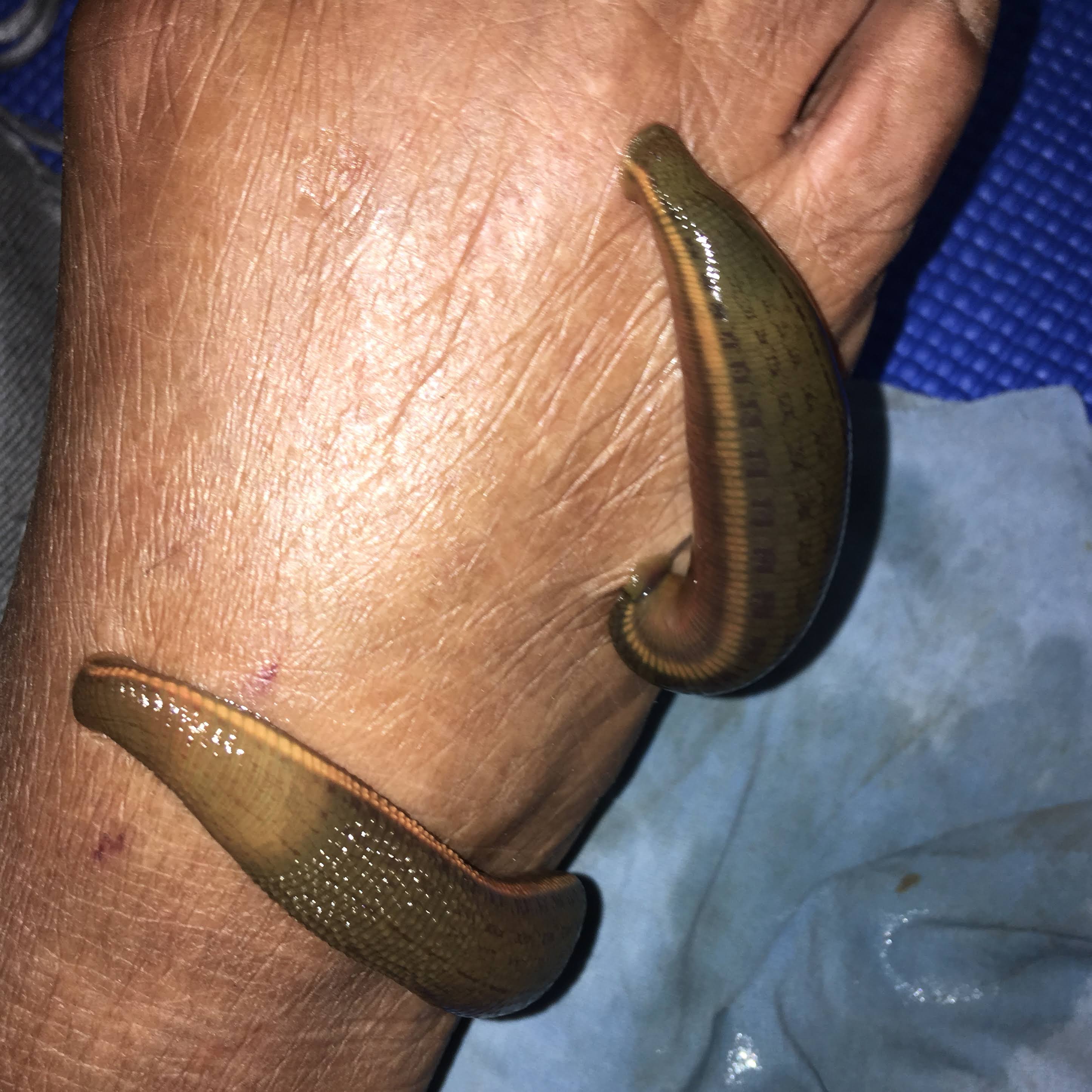 Leech therapy product image