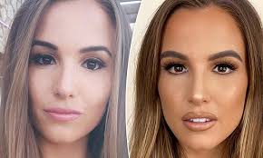 The anthropomorphic echidna millie was a mascot for the 2000 summer olympics. Love Island Australia S Millie Fuller Star Sparks Cosmetic Work Rumours Daily Mail Online