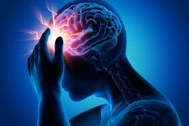 Apr 05, 2021 · pain is a general term that describes uncomfortable sensations in the body. Pain Researchers Pinpoint Female Specific Migraine Triggers News Center