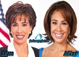 Her face in recent years has appeared stretched and reduced any form of sagging signs. Jeanine Pirro Plastic Surgery Before And After Pictures Plastic Surgery Facts