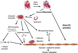 However, more than half of the cases (52.5%) of heart inflammation have come. Subclinical Inflammation In Heart Failure A Neutrophil Perspective Sciencedirect