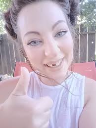 Tooth replacement options and recommendations?