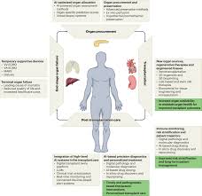 Image result for Transplantation