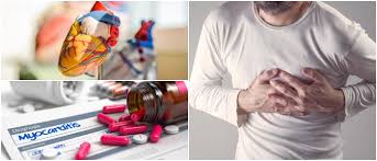 Es un estado inflamatorio del corazón específicamente del músculo cardiaco, causado con frecuencia por un agente infeccioso. Miocarditis Definicion Causas Sintomas Diagnostico Tratamiento Prevencion Y Complicaciones Arriba Salud