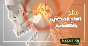 علاج الفك الصدغي بالاعشاب movie posters movies poster