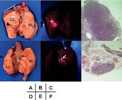 Lymph nodes are small glands all around your body that are part of. Fluorescence Diagnosis Of Lymph Node Metastasis Of Lung Cancer In A Mouse Model Semantic Scholar