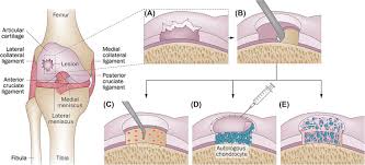 It rests inferior to the thyroid cartilage. Hyaline Cartilage An Overview Sciencedirect Topics