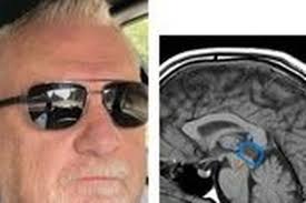 Fundraiser by Brian Ropp : BRAIN SURGERY: Financial Assist to travel