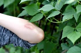 Check spelling or type a new query. Poisonous Plants In The Amazon Rainforest Rainforest Cruises